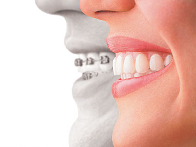 Everything Smiles | CEREC, Oral Cancer Screening and Pediatric Dentistry
