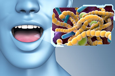 Everything Smiles | Root Canals, Fluoride Treatment and Dental Cleanings