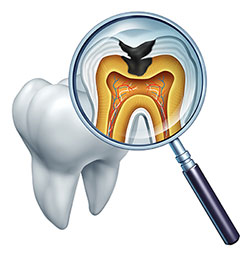 Everything Smiles | Veneers, Crowns and Extractions
