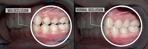 Everything Smiles | Dental Cleanings, Botox reg  and Sports Mouthguards