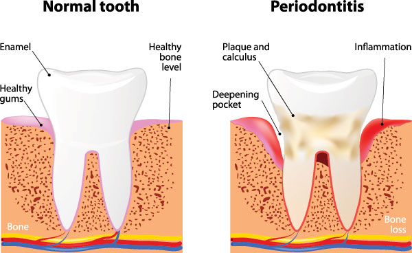 Everything Smiles | Dental Fillings, Veneers and CBCT