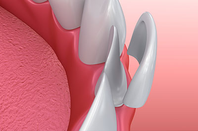 Everything Smiles | Cosmetic Dentistry, Oral Cancer Screening and Pediatric Dentistry