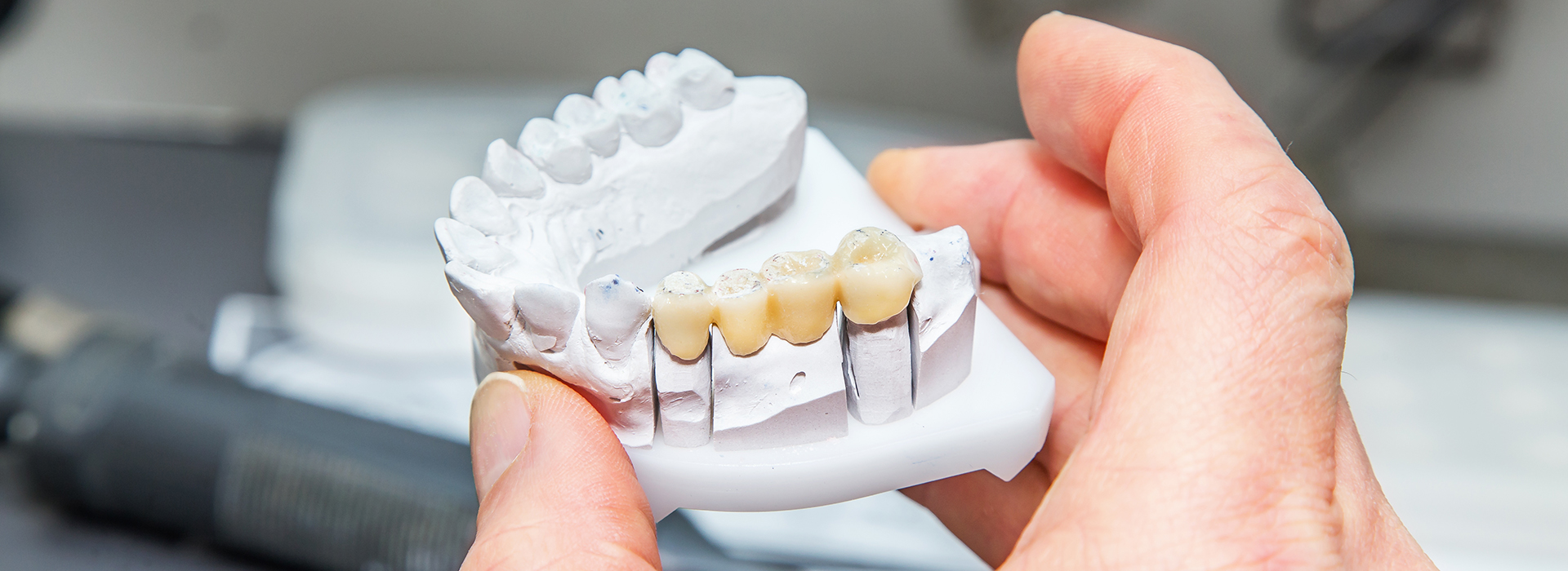 Everything Smiles | Dental Sealants, CBCT and Night Guards