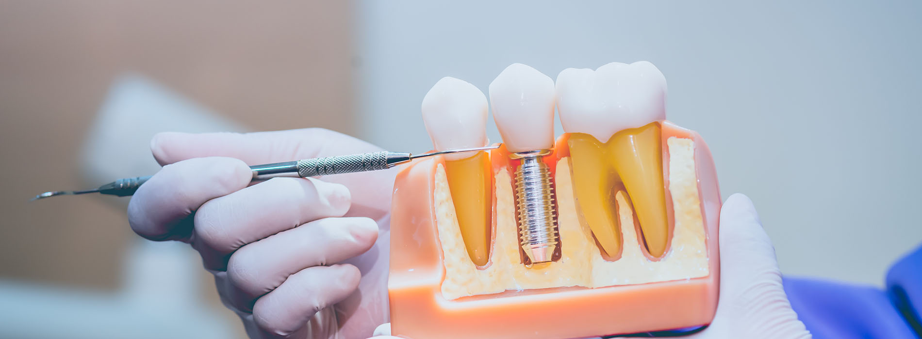 Everything Smiles | Oral Exams, Botox reg  and Digital Radiography