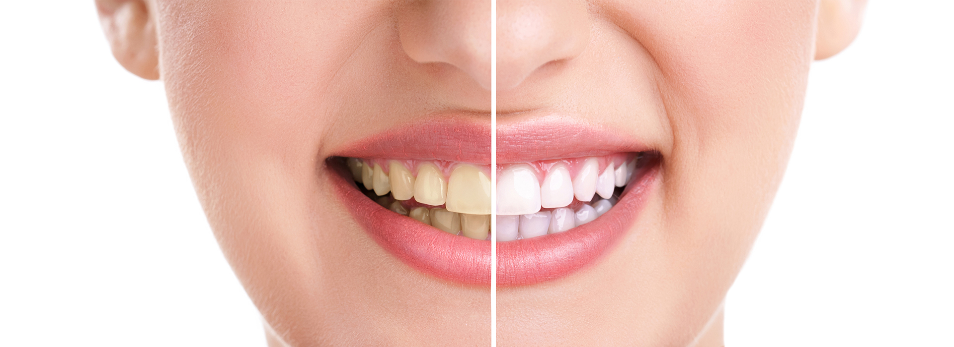 Everything Smiles | Orthodontics, Oral Exams and Preventative Program